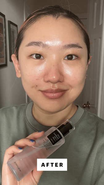 Han after applying the CosRx BHA Blackhead Power Liquid Treatment